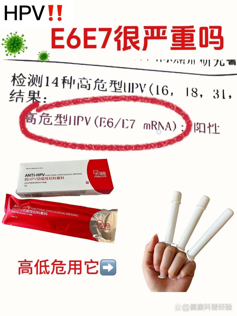 hpv的检查会有误诊吗?要则么治疗呢被误诊hpv花光积蓄会传染吗hpv的检查会有误诊吗?要则么治疗呢 车型(336193)